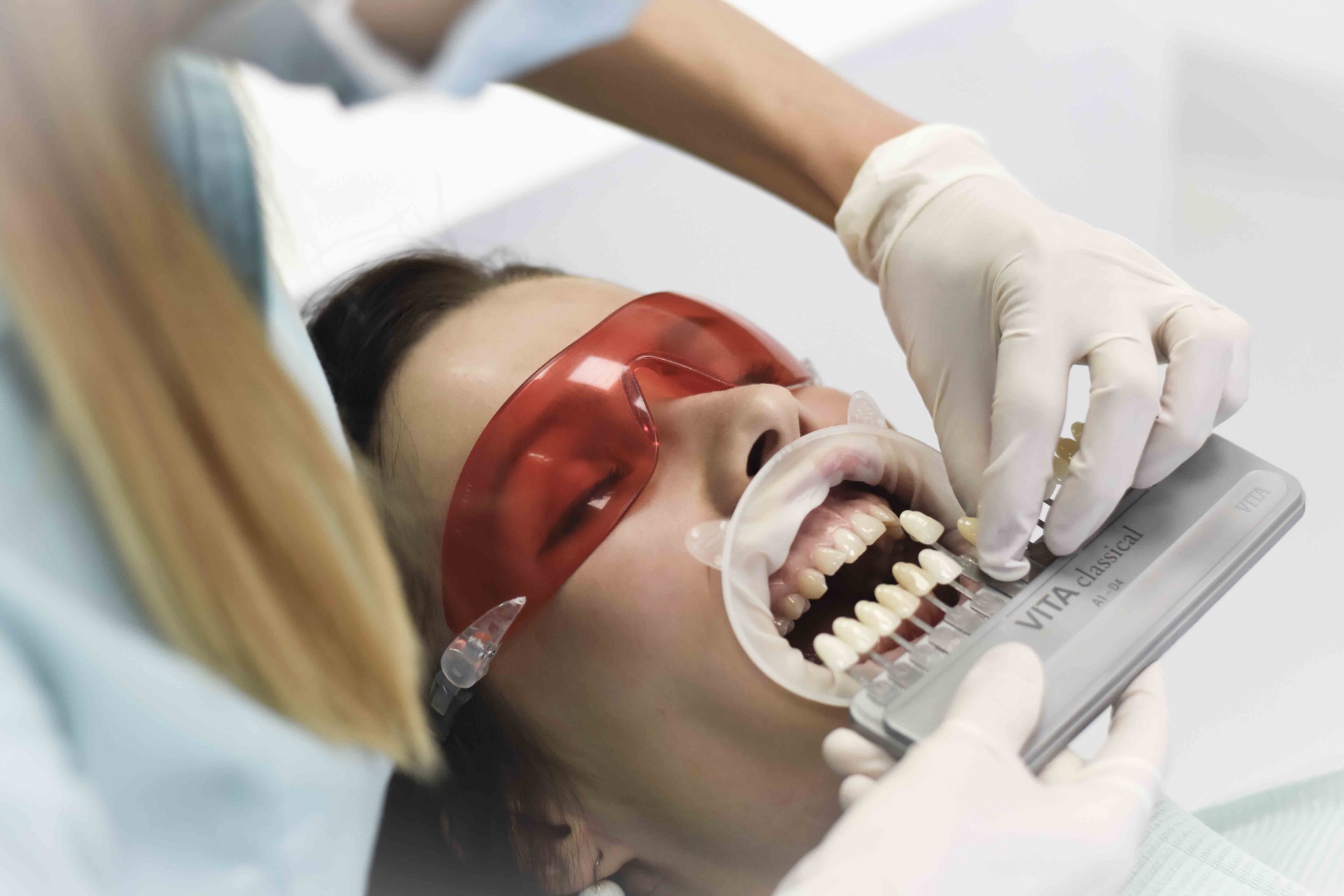 /dental/osetrenia/zakroky/bielenie-zubov/bielenie-zubov-2.jpg