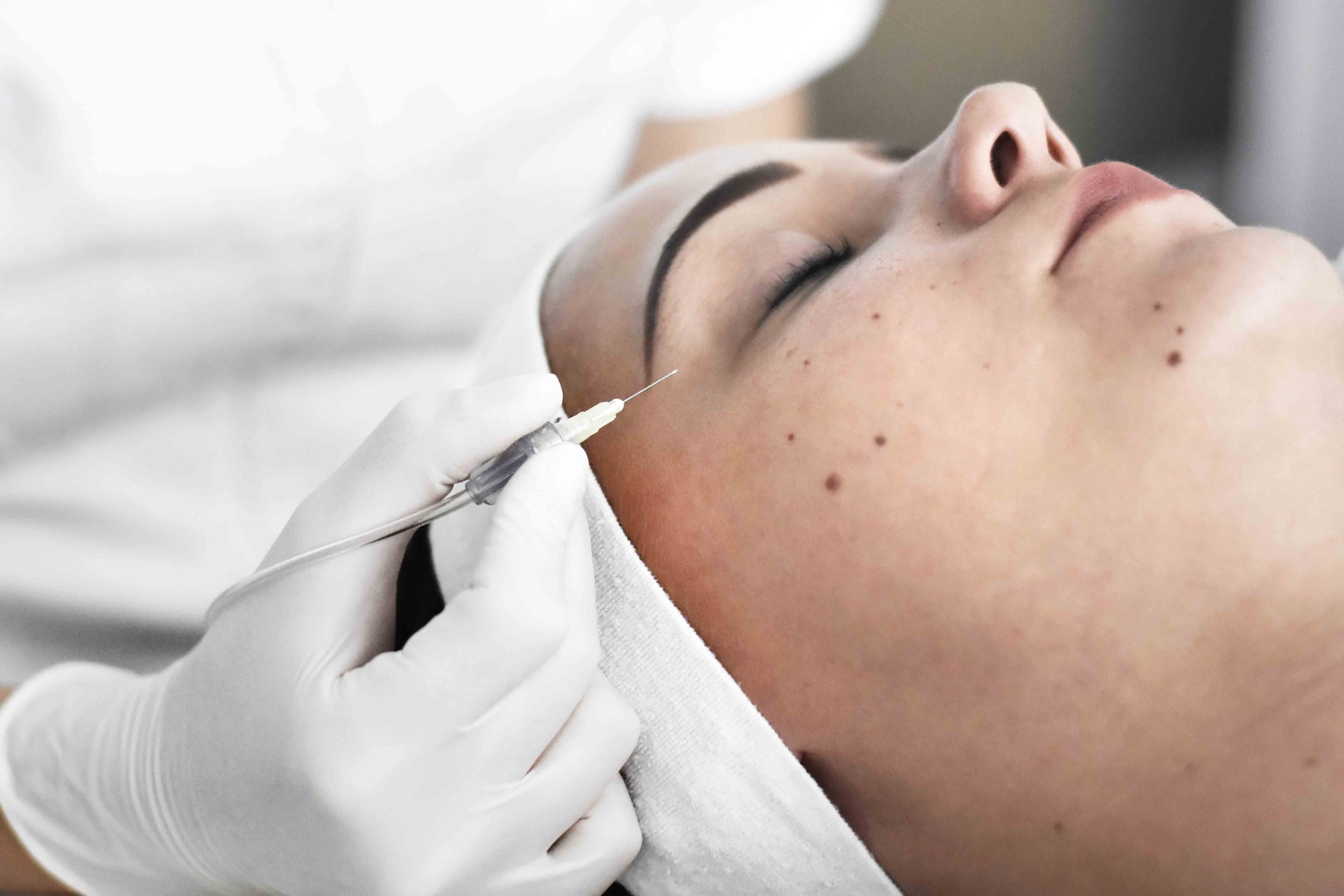 Carboxy Terapia | Derma Center