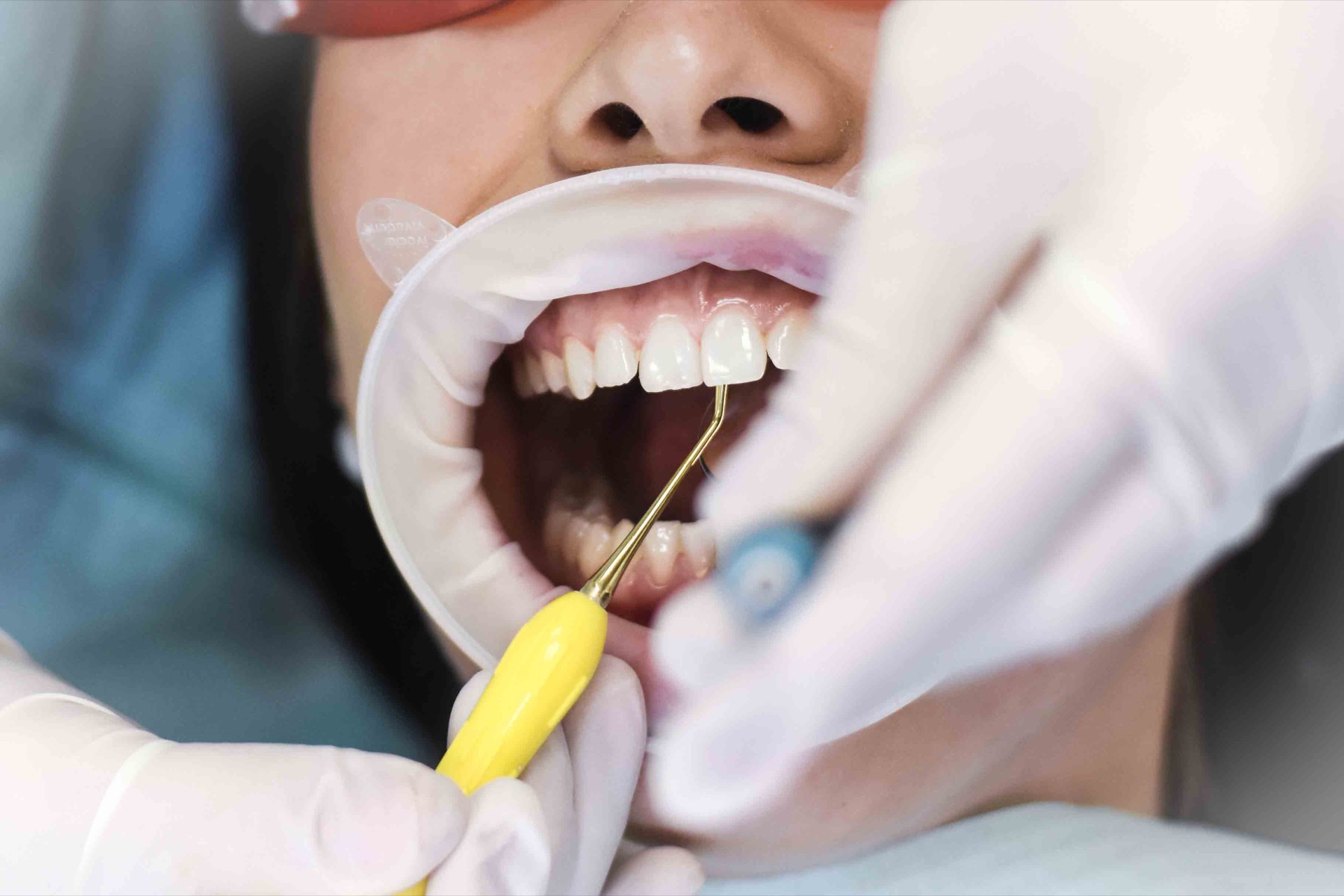 dentalna-hygiena-2