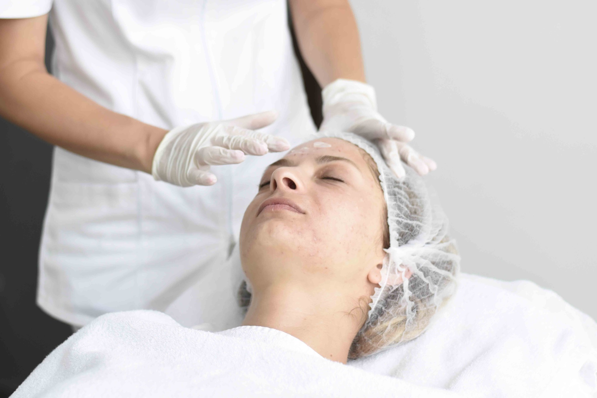 Medicamentosa treatment of acne | Derma Center