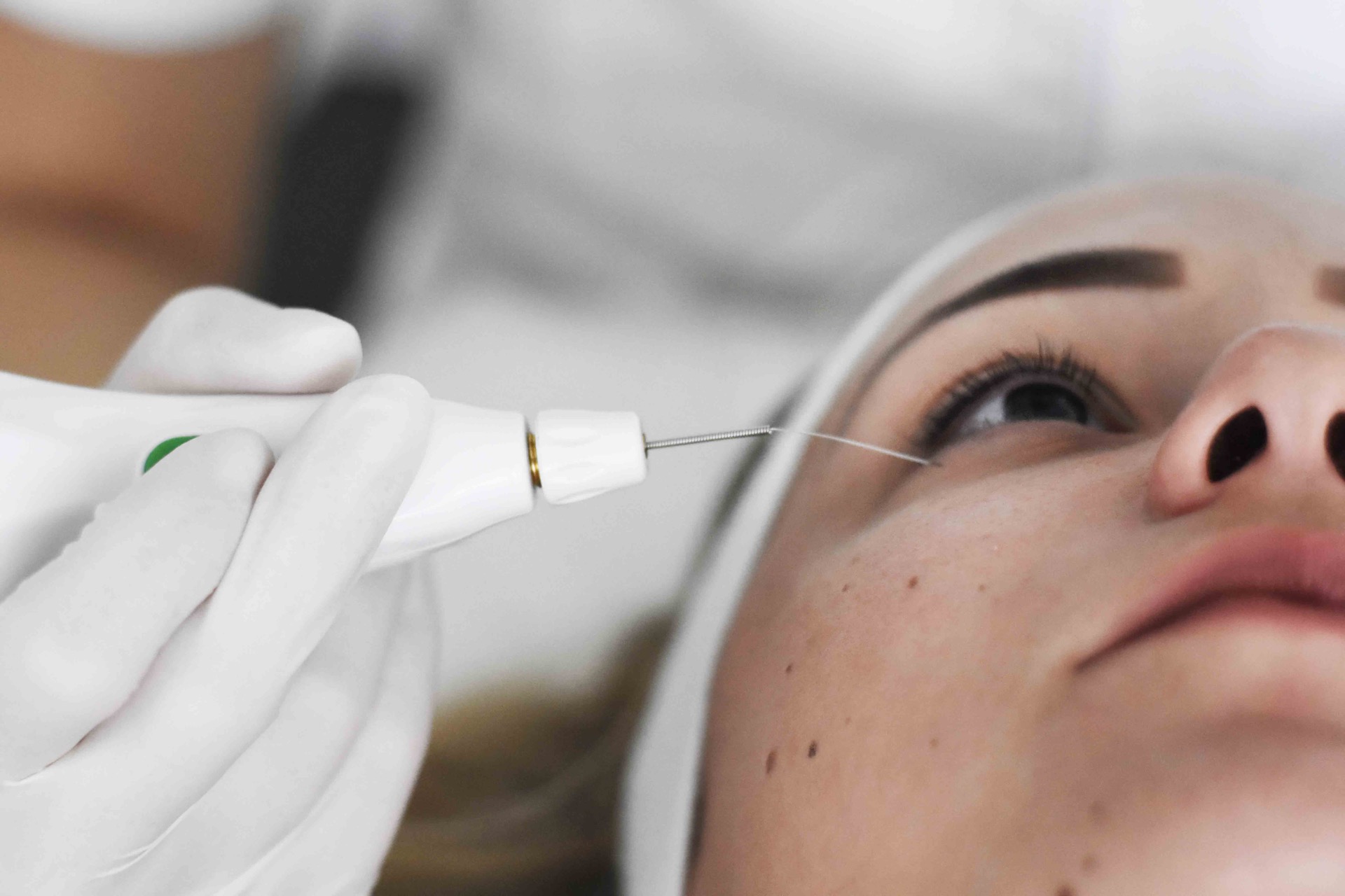 Plexr Machine PLEXR | Derma Center